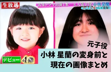 小林星蘭の変身前と現在の画像は?顔が劣化でコンプレックス?出演作品も激減していた?