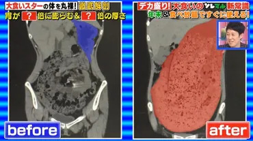 衝撃映像】もえあずの大食い後のお腹のCTスキャン画像がやばい 