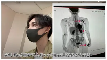 かすり傷゛放置で「片腕切断」歳男性の驚く顛末「医師宣告を動画配信」する超前向きな人生観