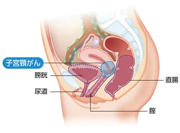 転移と再発 