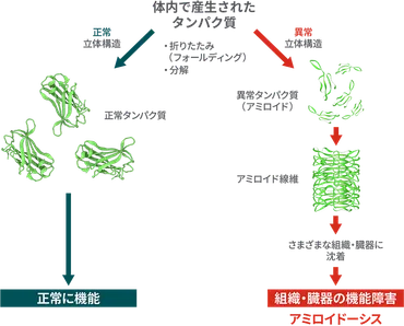 全身性アミロイドーシスってどんな病気？とは！？