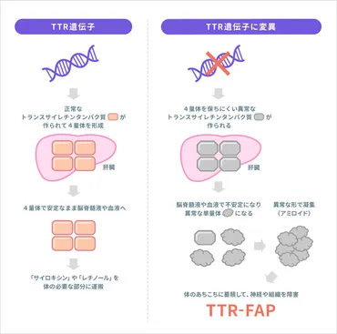 トランスサイレチン型家族性アミロイドポリニューロパチー 