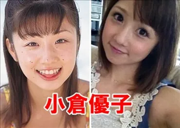 小倉優子は整形していた?!目と鼻とホクロを整形をしていた事が ...