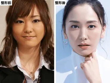 新垣結衣は万円の整形で「なりたい顔ランキング」常連に!?昔から現在の画像で目や顎などの変化を徹底検証!