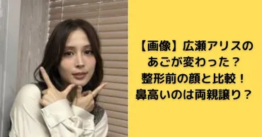 画像】広瀬アリスのあごが変わった?整形前の顔と比較!鼻高いのは両親譲り?
