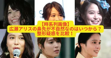 時系列】広瀬アリスの鼻先(鼻筋)が高いのはいつから?整形疑惑を比較!