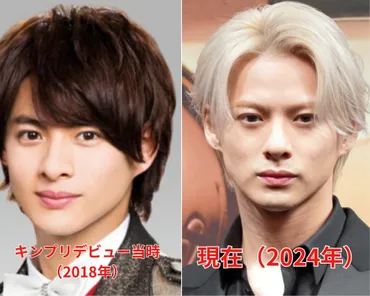 最新平野紫耀の顔変わった痩せた?老けたの声も理由つを画像検証