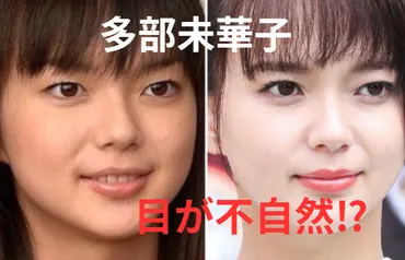 多部未華子の二重が不自然!?いつからなのか時系列で画像で検証!