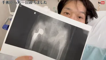 千原ジュニア、難病「特発性大腿骨頭壊死症」の術後レポートが壮絶 「もっと楽やと思ってた」「シャレならん痛み」（1/2 ページ） 