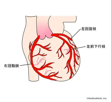 虚血性心疾患（狭心症・心筋梗塞）を早期発見するためにできること――原因や症状、検査法について解説 