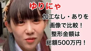 ゆりにゃの加工なし・ありの顔を画像で比較！整形金額は500万！ 