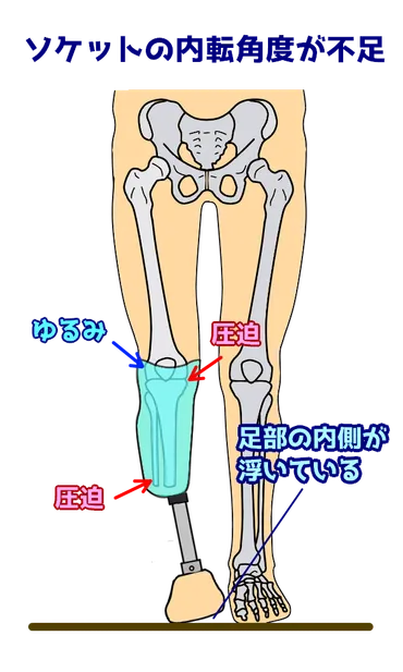 第56回理学療法士国家試験解説AM