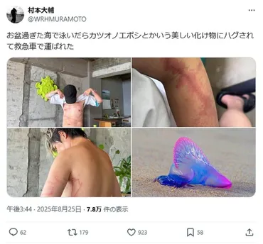 カツオノエボシに刺された」岡山・宇野港で深夜に海に飛び込む ウーマン村本がSNS投稿、県「危険なので止めてほしい」: J