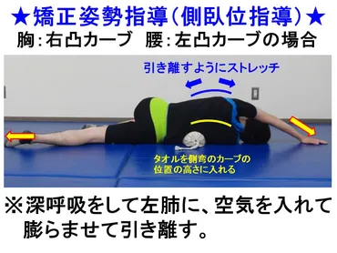 側弯症：日常生活での姿勢の注意点（矯正姿勢について） – わしざわ整形外科 新着ニュース