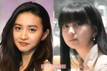 CocomiとKoki,の顔面、どちらが美しい？ 美容整形外科医がジャッジ「決め手は横顔」 