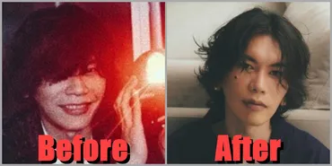 米津玄師の身長が高い理由はマルファン症候群？体重や前髪を伸ばしている理由も 