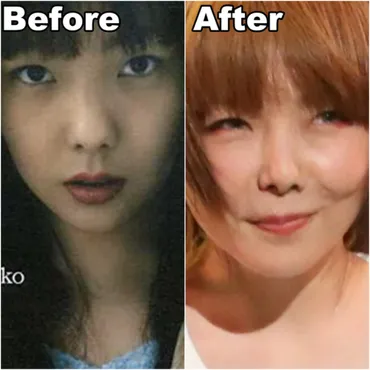 aikoの美貌は整形？デビューからの顔の変化と美の秘訣を徹底検証！(？マーク)aikoの整形疑惑と美の秘訣