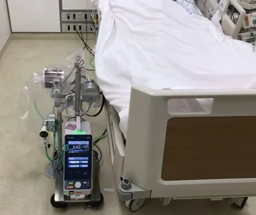 新型コロナ治療の切り札、ECMOの知られざる光と影 実録・新型コロナウイルス集中治療の現場から（第3回）(1/5) 