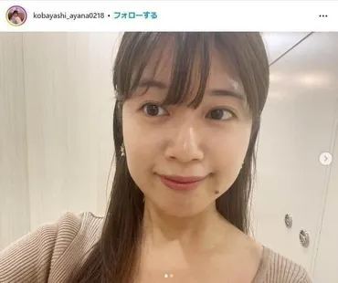 小林礼奈、離婚直後は「男に依存してた」が... 結婚観に変化「もう苦しい思いしたくない」: J