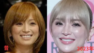 最新】浜崎あゆみの顔が変わりすぎアゴの整形で別人に