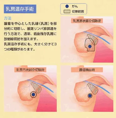 よくあるご質問 乳がん 福岡大学医学部呼吸器外科