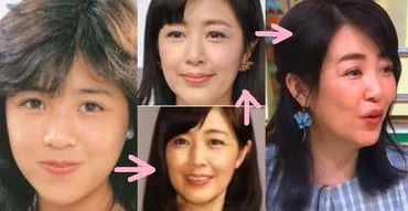 菊池桃子 顔が変わった！むくみの理由はヒアルロン酸？ビフォーアフター画像