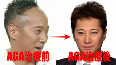 中居正広の生え際の薄毛対策は治療!植毛・かつら疑惑も暴露!